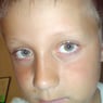 Isager1999
